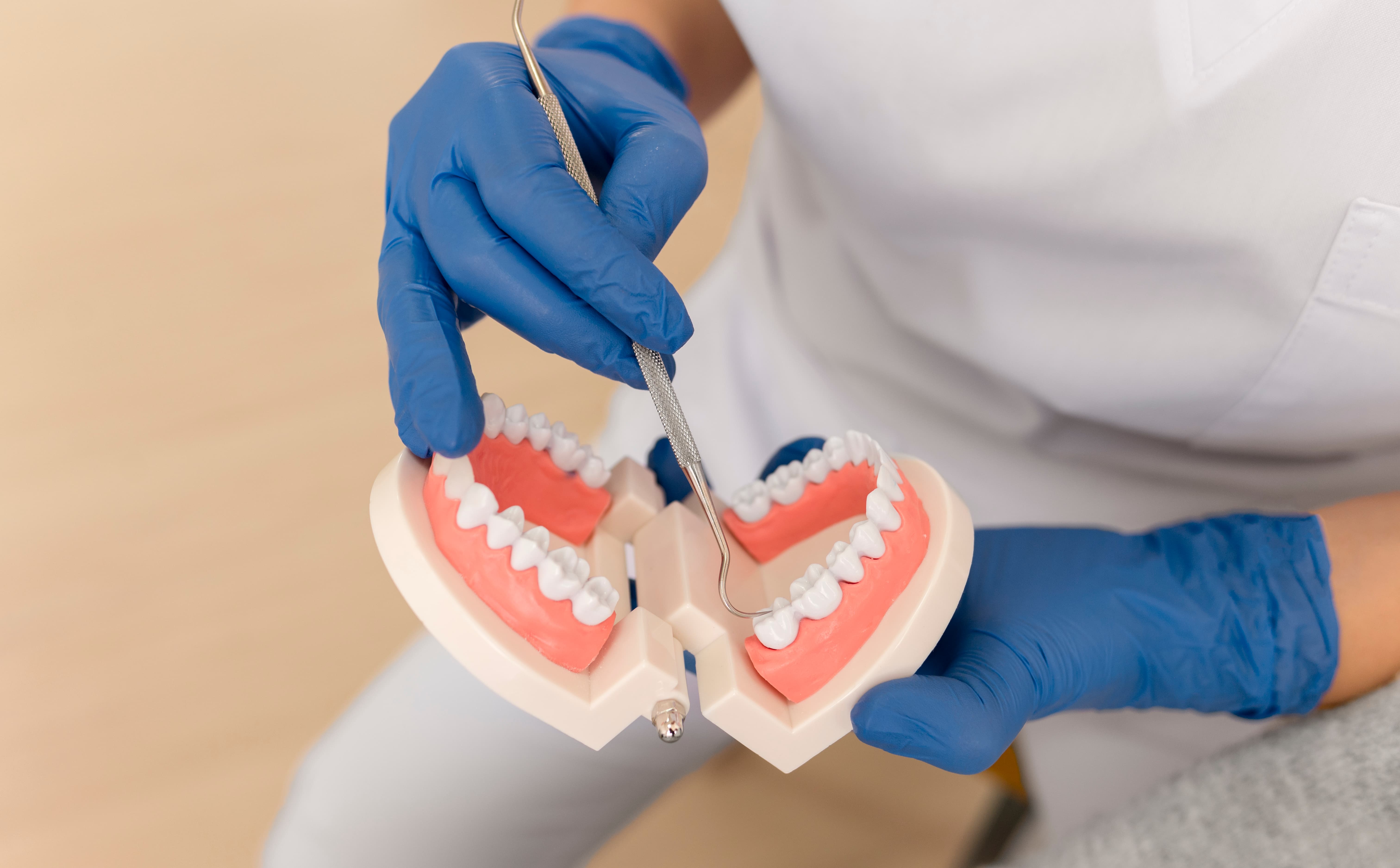 Rehabilitación oral